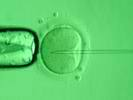 Инъекция сперматозоида в цитоплазму яйцеклетки икси  2