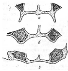  классификация беззубых челюстей 2